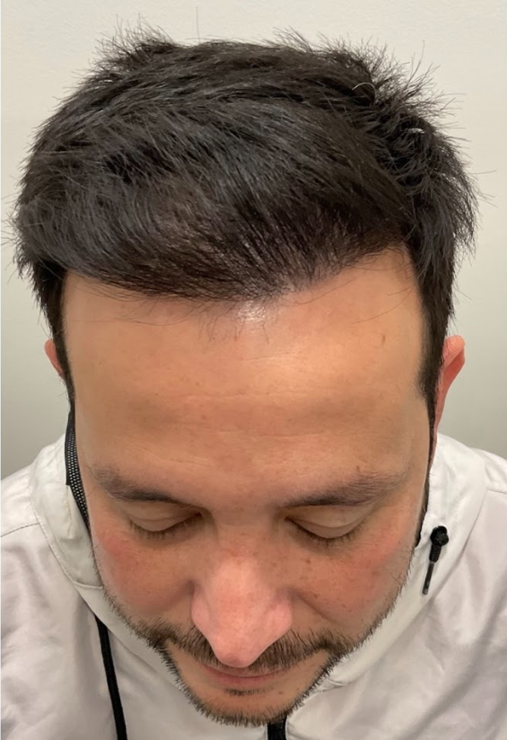 HAIR SPECIALIST